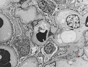 M,34y. | normal kidney